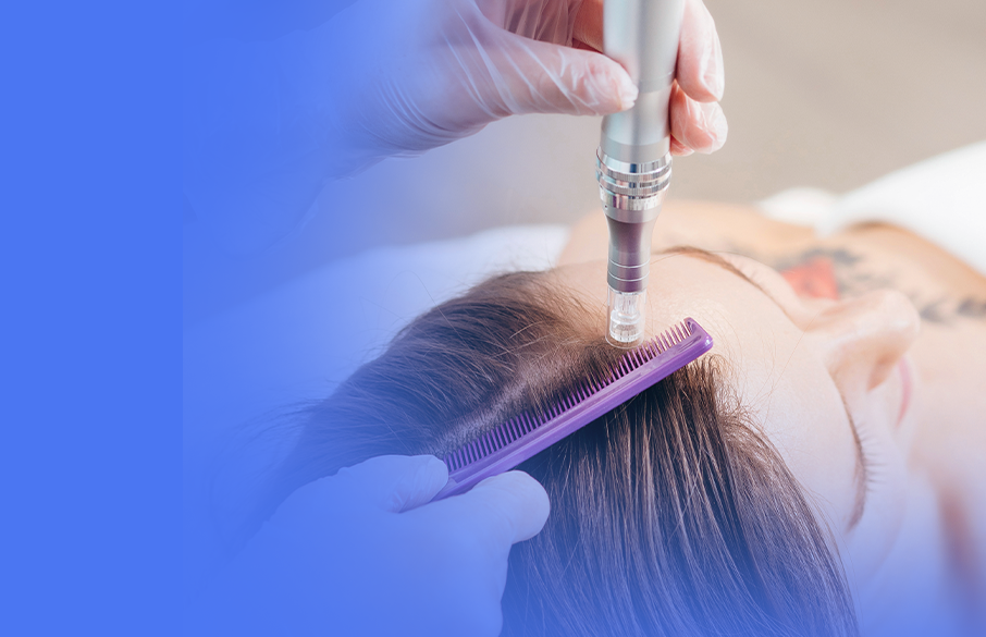 UniVS está com inscrições abertas para Curso Livre em Terapia Capilar