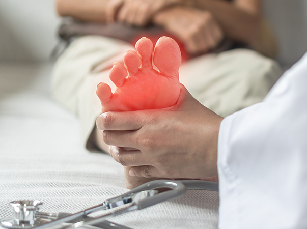 UniVS oferta curso livre de Tratamento de Disfunções em Podiatria